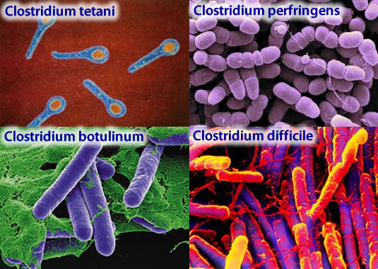 clostridium_bacteria